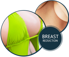 Breast Reduction