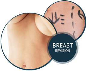 Breast Revision